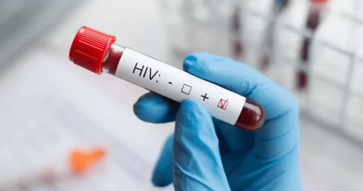 VIH en El Salvador: hombres representan el 85 % de los 229 nuevos casos en 2026